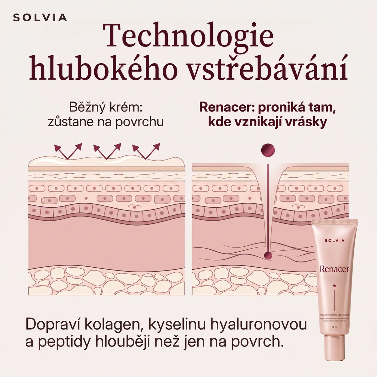 Technologie hlubokého vstřebávání