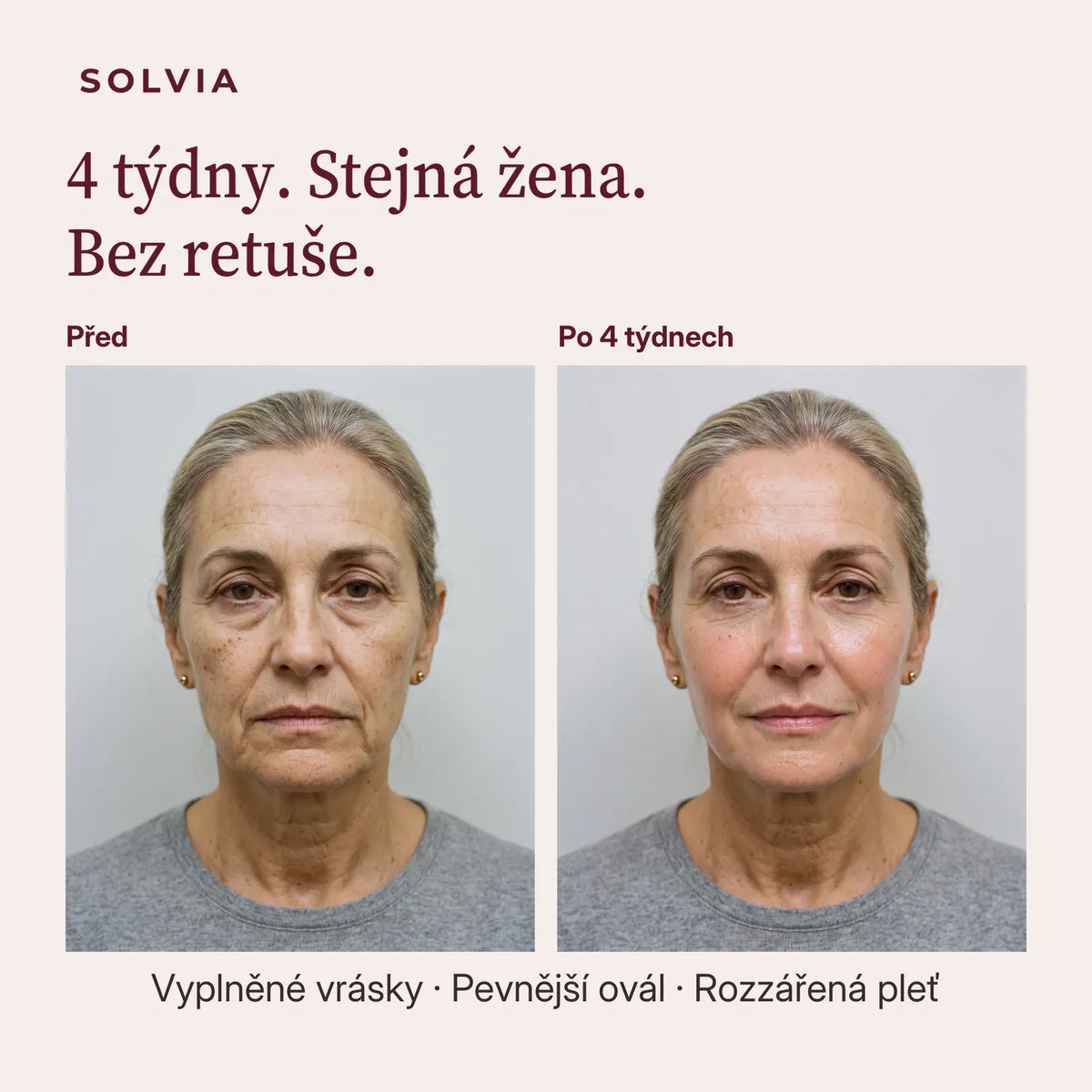 4 týdny. Stejná žena. Bez retuše.