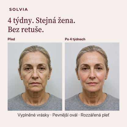 4 týdny. Stejná žena. Bez retuše.