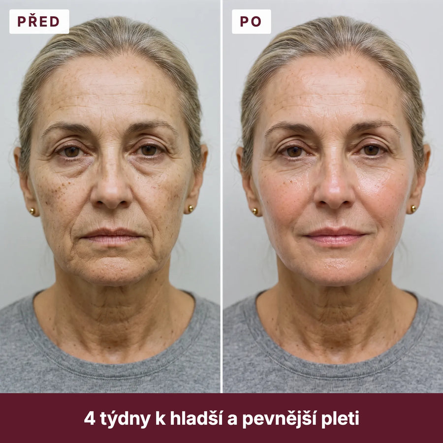 Před a po: 4 týdny k hladší a pevnější pleti
