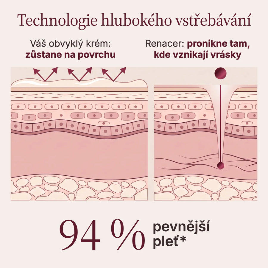Technologie hlubokého vstřebávání: Renacer pronikne tam, kde vznikají vrásky