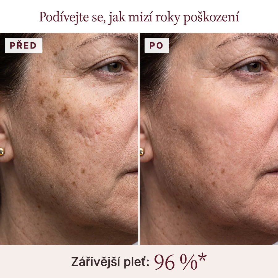 Podívejte se, jak mizí roky poškození